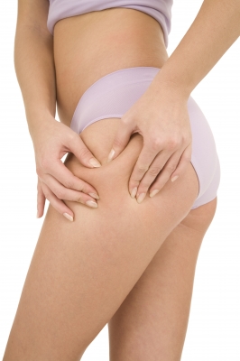 La cryolipolyse en centre laser : la solution anti-cellulite ?